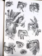 Traité complet de l'anatomie de l'Homme, comprenant la médecine chirurgicale et la médecine opératoire, avec planches lithographiées d'après nature. COLLECTION COMPLÈTE.  par BOURGERY, Jean-Marc ; BERNARD, Claude ; JACOB, Nicolas Henri ; DUCHAUSSOY, Dr.  - Image 20