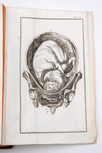 Elémens de l'art des accouchemens. Augmentés des Observations sur les Accouchemens Laborieux. A l'usage des Etudians en Médecine et en Chirurgie. Traduits sur la dernière Edition par M****, avec figures.