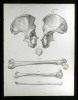 Knochenlehre.. Erdl, M(ichael) P(ius) (1815-1848):