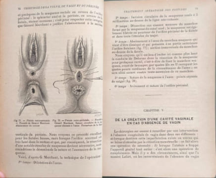 Chirurgie de l'appareil génital de la femme. R. Proust et J. Charrier