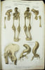 Mus&eacute;e d'anatomie de la Facult&eacute; de m&eacute;decine de Strasbourg. Description de deux foetus monstres, dont l'un ac&eacute;phale et l'autre monopode.. EHRMANN, ...