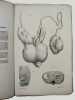 De tubercule du testicule.. RECLUS, Paul