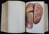 Traité de pathologie mentale. Publié sous la direction de G. Ballet par MM. Anglade, Arnaud, Colin, Dupré, Roubinovitch, Séglas, Vallon.