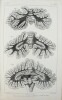 Recherches sur le système nerveux cérébro-spinal. Sa structure, ses fonctions et ses maladies.. LUYS, Jules