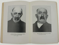 Etude sur la vieillesse et le rajeunissement par la greffe.