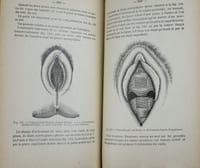 Leçons de gynécologie opératoire.