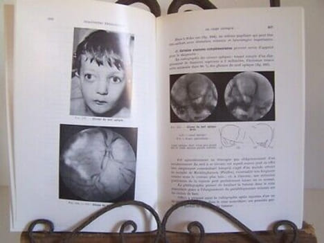 Martine FONTAINE Les CECITES de L'ENFANCE. undefined