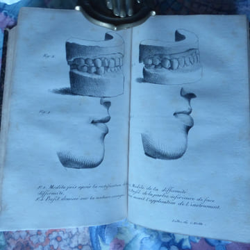 [I]- BOURDON (Isidore) : Essai sur l’influence de la pesanteur sur quelques phénomènes de la vie.  Paris, de l’Imprimerie de A Belin, 1819. 32pp. ...