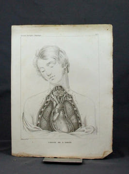 Traité d’anatomie descriptive, rédigé d’après l’ordre adopté à la faculté de médecine de Paris. Angéiologie.. CLOQUET Hippolyte: