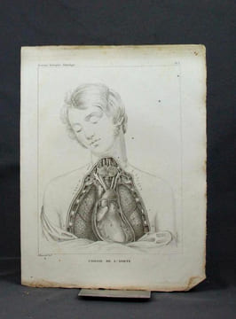 Traité d’anatomie descriptive, rédigé d’après l’ordre adopté à la faculté de médecine de Paris. Angéiologie.. CLOQUET Hippolyte: