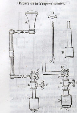 Oeuvres complètes d'Ambroise Paré, revues et collationnées sur toutes les éditions, avec les variantes; [...] accompagnées de notes historiques et ...