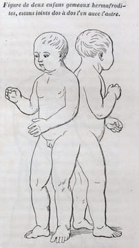 Oeuvres complètes d'Ambroise Paré, revues et collationnées sur toutes les éditions, avec les variantes; [...] accompagnées de notes historiques et ...