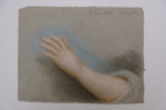 Bras d'enfant. Inconnu