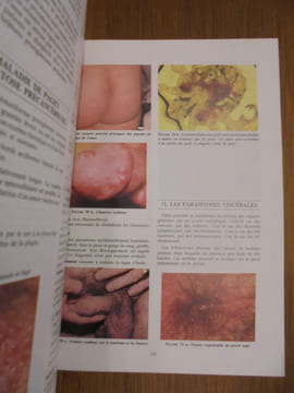 UROLOGIE, PATHOLOGIE INFECTIEUSE ET PARASITAIRE. KHOURY S. & ALII