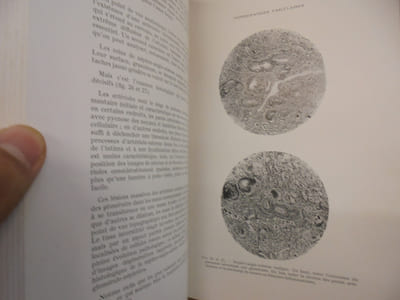 Pathologie Médicale Tome II Reins - Appareil digestif - Maladies Allergiques - Os et Articulations - Muscles