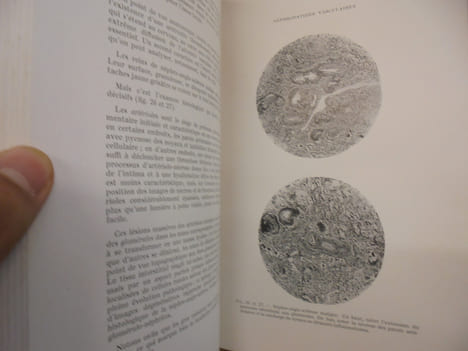 Pathologie Médicale Tome II Reins - Appareil digestif - Maladies Allergiques - Os et Articulations - Muscles. Vallery-Radot Jean Hamburger François ...