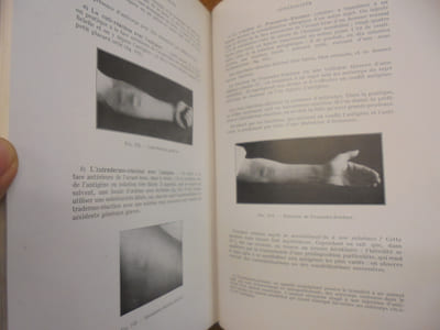 Pathologie Médicale Tome II Reins - Appareil digestif - Maladies Allergiques - Os et Articulations - Muscles