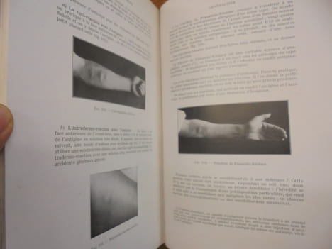 Pathologie Médicale Tome II Reins - Appareil digestif - Maladies Allergiques - Os et Articulations - Muscles. Vallery-Radot Jean Hamburger François ...