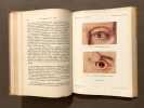 La tuberculose de l'oeil et de ses annexes. . ROLLET (E.) et A. COLRAT
