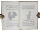 Case of Cerebral Tumor. Read May 12th, 1885. [Offprint from ""Medico-Chirurgical Transactions"", Vol. 68]. - [FIRST REMOVAL OF A BRAIN TUMOR]. ...
