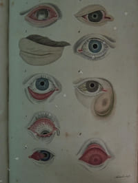TRAITE   THEORIQUE    ET   PRATIQUE   DES   MALADIES   DES  YEUX   par  M.  le  Docteur  Weller  médecin  oculiste de la ville de Dresde , traduit  de l ' allemand sur la dernière édition par J. Riester ;  augmenté de notes par L. Jallat docteur en médecine