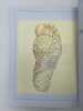 Atlas d'anatomie des veines superficielles des membres inférieurs. BLANCHEMAISON PHILIPPE 