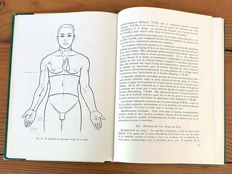 EO Précis d'acupuncture chinoise (. undefined