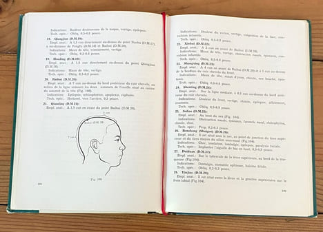 EO Précis d'acupuncture chinoise (. undefined