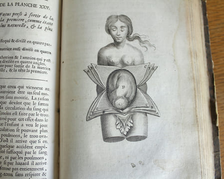 L'anatomie du corps humain avec ses maladies,& les remèdes pour les guérir nouvelle édition augmentée de plusieurs observations de phisique curieuses ...