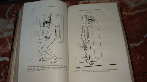 ÉTUDE MÉDICO-LÉGALE SUR LA PENDAISON, LA STRANGULATION ET LA SUFFOCATION. TARDIEU Ambroise