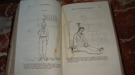 ÉTUDE MÉDICO-LÉGALE SUR LA PENDAISON, LA STRANGULATION ET LA SUFFOCATION. TARDIEU Ambroise