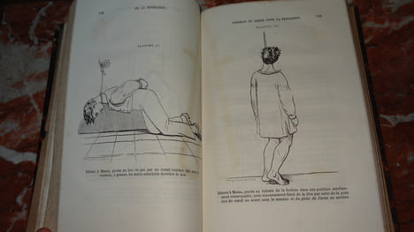 ÉTUDE MÉDICO-LÉGALE SUR LA PENDAISON, LA STRANGULATION ET LA SUFFOCATION. TARDIEU Ambroise