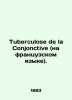 Tuberculose de la Conjonctive. In Russian /Tuberculose de la Conjonctive (na fr. 