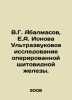 V.G. Abalmasov, E.A. Ionova Ultrasound examination of the operated thyroid glan. Ionov, Alexander Mikhailovich