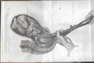 L'Art des Accouchemens