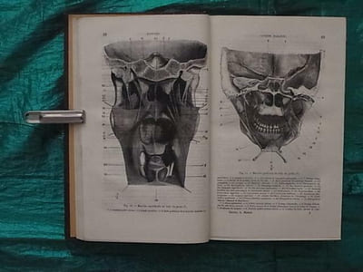 TRAITE THEORIQUE ET PRATIQUE DE L'ART DU DENTISTE, COMPRENANT L'ANATOMIE, LA PHISIOLOGIE, LA PATHOLOGIE, LA THERAPEUTIQUE, LA CHIRURGIE ET LA PROTHESE DENTAIRES 