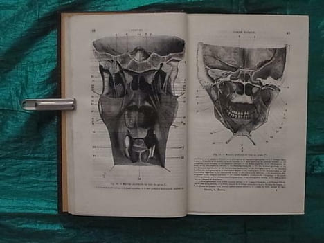 TRAITE THEORIQUE ET PRATIQUE DE L'ART DU DENTISTE, COMPRENANT L'ANATOMIE, LA PHISIOLOGIE, LA PATHOLOGIE, LA THERAPEUTIQUE, LA CHIRURGIE ET LA PROTHESE ...