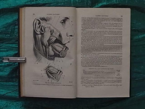 TRAITE THEORIQUE ET PRATIQUE DE L'ART DU DENTISTE, COMPRENANT L'ANATOMIE, LA PHISIOLOGIE, LA PATHOLOGIE, LA THERAPEUTIQUE, LA CHIRURGIE ET LA PROTHESE ...