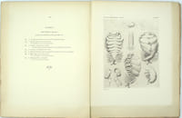 Contribution A L'étude Des Épicarides, Les Bopyridae