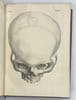 Ost&eacute;o-graphie ou description des os de l’adulte, du foetus.... TARIN.  Pierre.