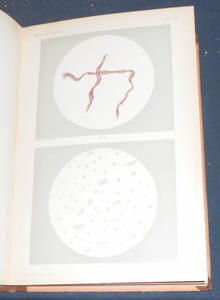 Mikroskopie der Harnsedimente (Microscopie des sédiments urinaires)