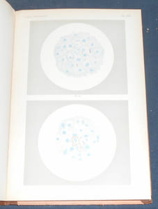 Mikroskopie der Harnsedimente (Microscopie des sédiments urinaires)