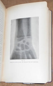 La Technique des Rayons X manuel opératoire de la radiographie et de la fluoroscopie à l'usage des médecins des chirurgiens et des amateurs de photographie