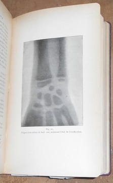 La Technique des Rayons X manuel opératoire de la radiographie et de la fluoroscopie à l'usage des médecins des chirurgiens et des amateurs de ...