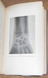La Technique des Rayons X manuel opératoire de la radiographie et de la fluoroscopie à l'usage des médecins des chirurgiens et des amateurs de photographie