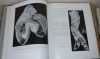 Les lésions organiques du Coeur. Étude Clinique, Anatomique et Thérapeutique. Masson et Cie. Paris. 1936.. LUTEMBACHER, R.