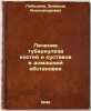 Lechenie tuberkuleza kostey i sustavov v domashney obstanovke. In Russian /Tr.... Lebedeva, Zinaida Alexandrovna