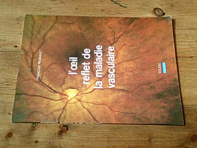 L'oeil reflet de la maladie vasculaire