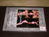 Anévrysmes de l'aorte abdominale. Conduite à tenir