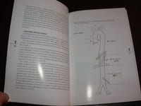 Anévrysmes de l'aorte abdominale. Conduite à tenir